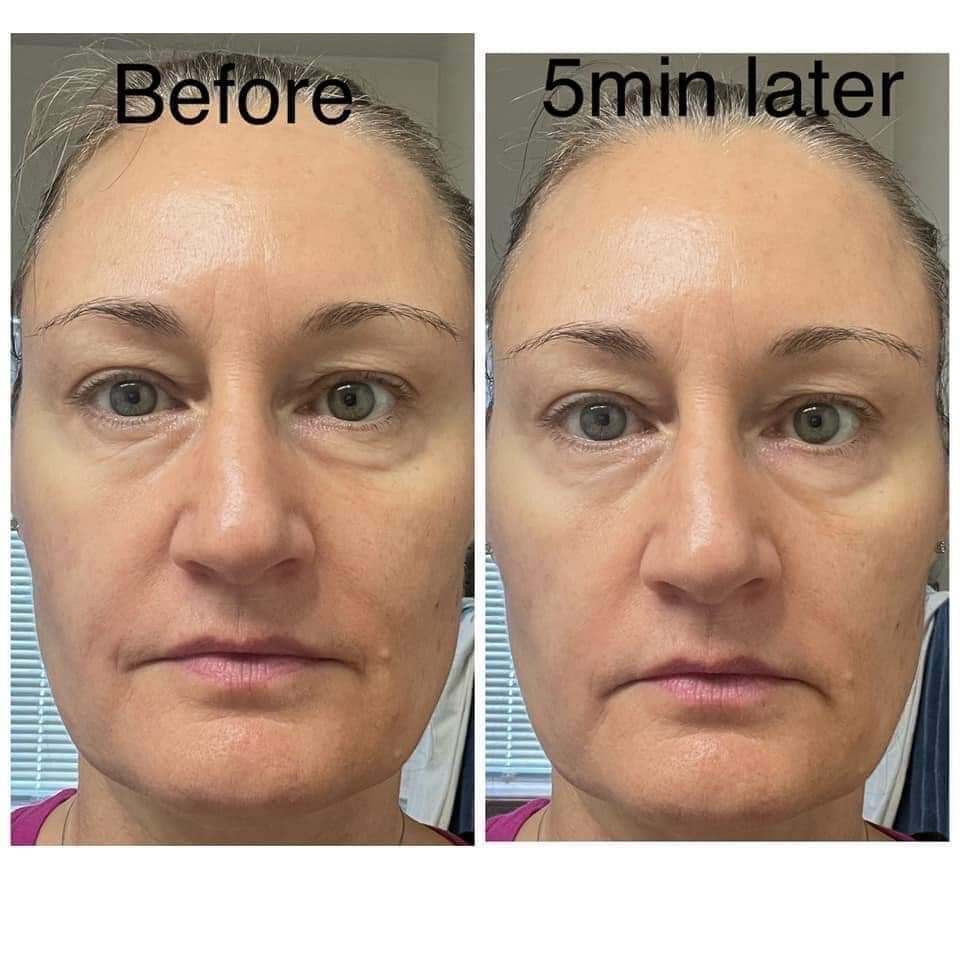 Ultra Uplifting Face Cream