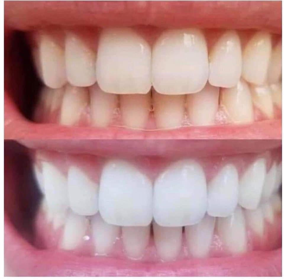 Whitening Fluoride Toothpaste