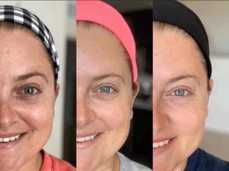 Vitamin C Facial Peel and Neutralizer