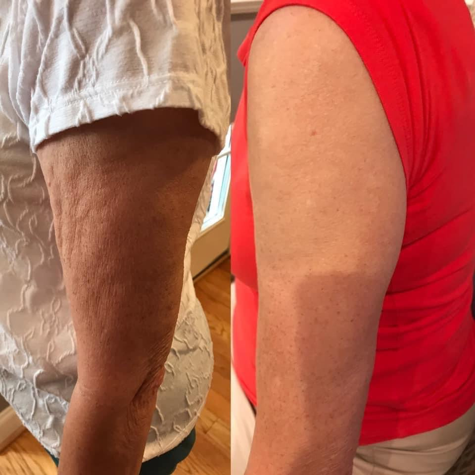 Firming Cream Dermatic Effects