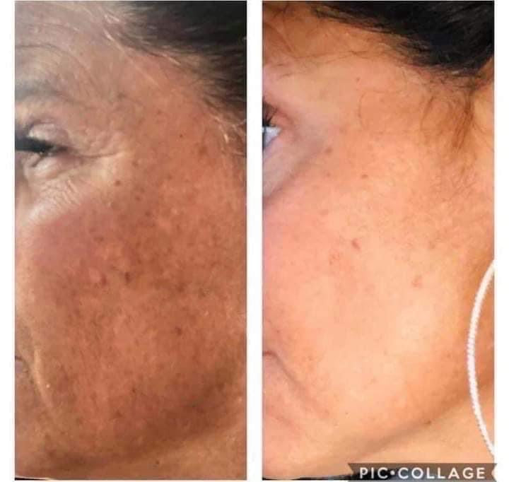 Vitamin C Facial Peel & Vitamin C Wash Combo