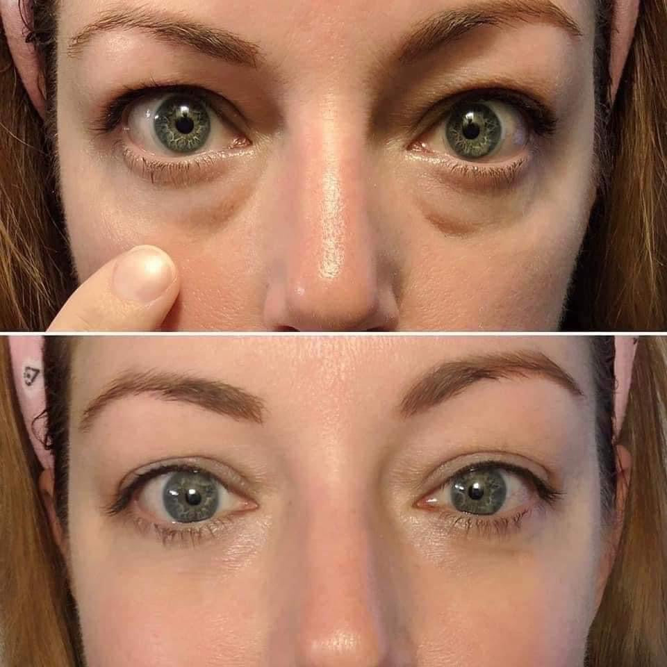 AgeLoc® IdealEyes®