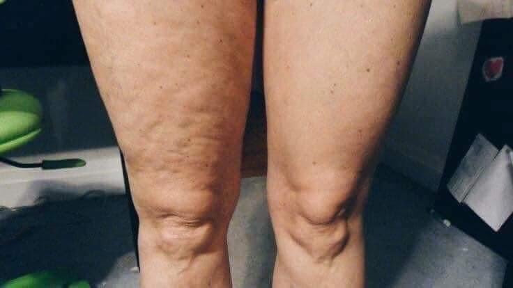 Firming Cream Dermatic Effects