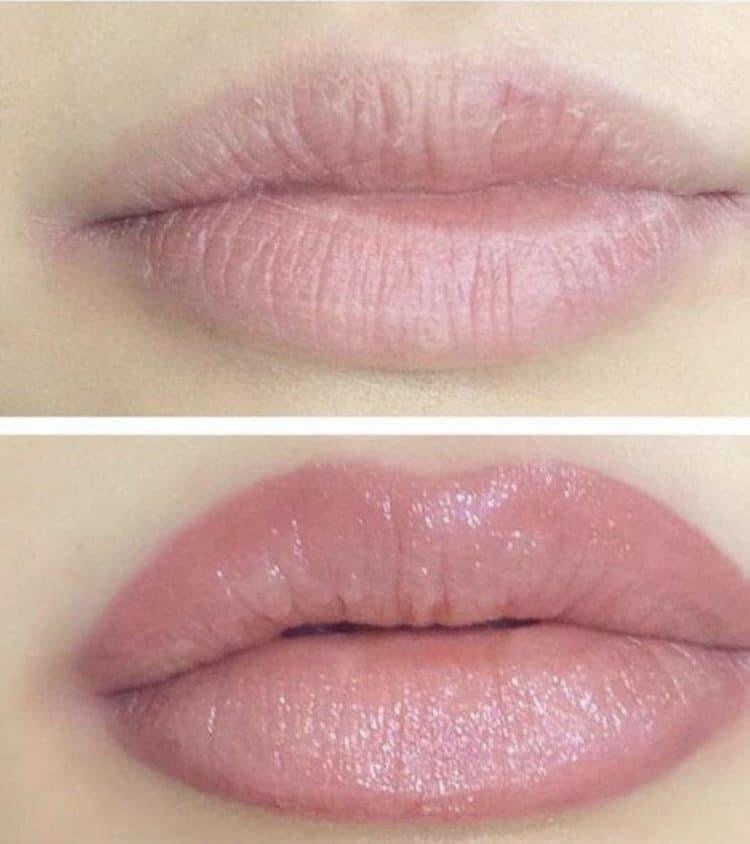 Lip Plumper