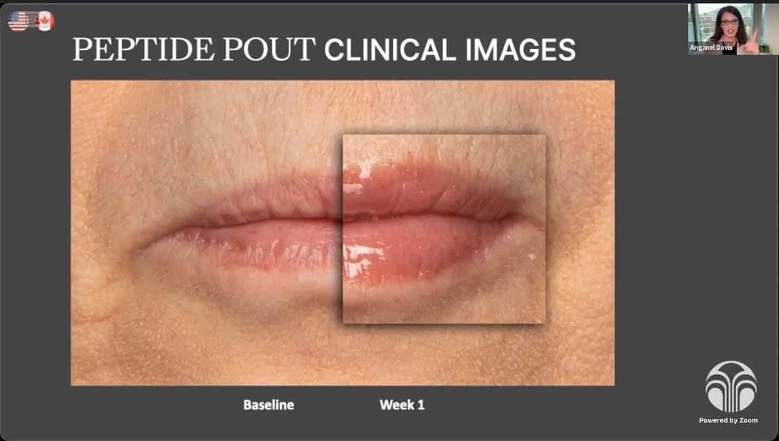 Peptide Pout