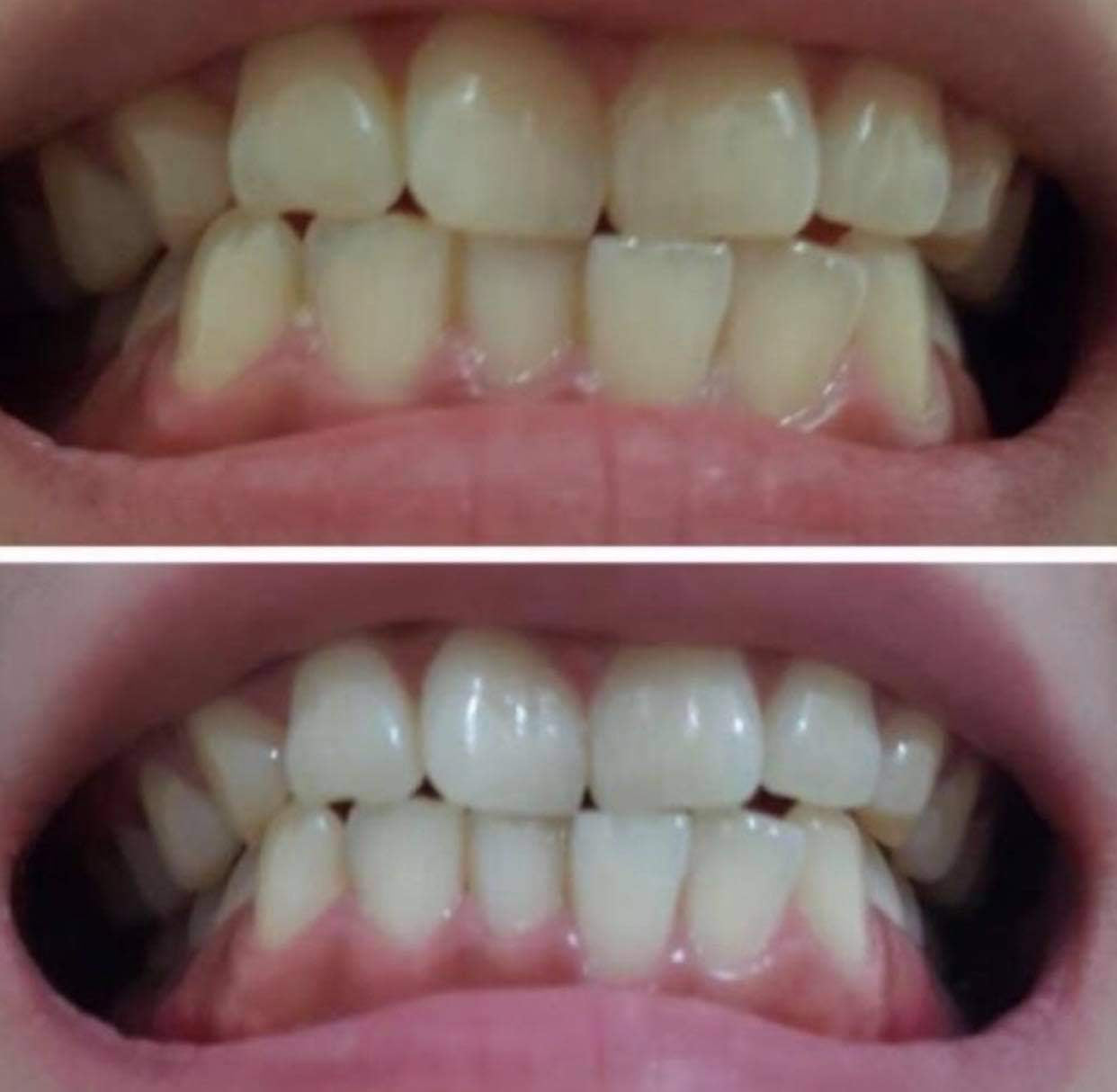 Whitening Fluoride Toothpaste