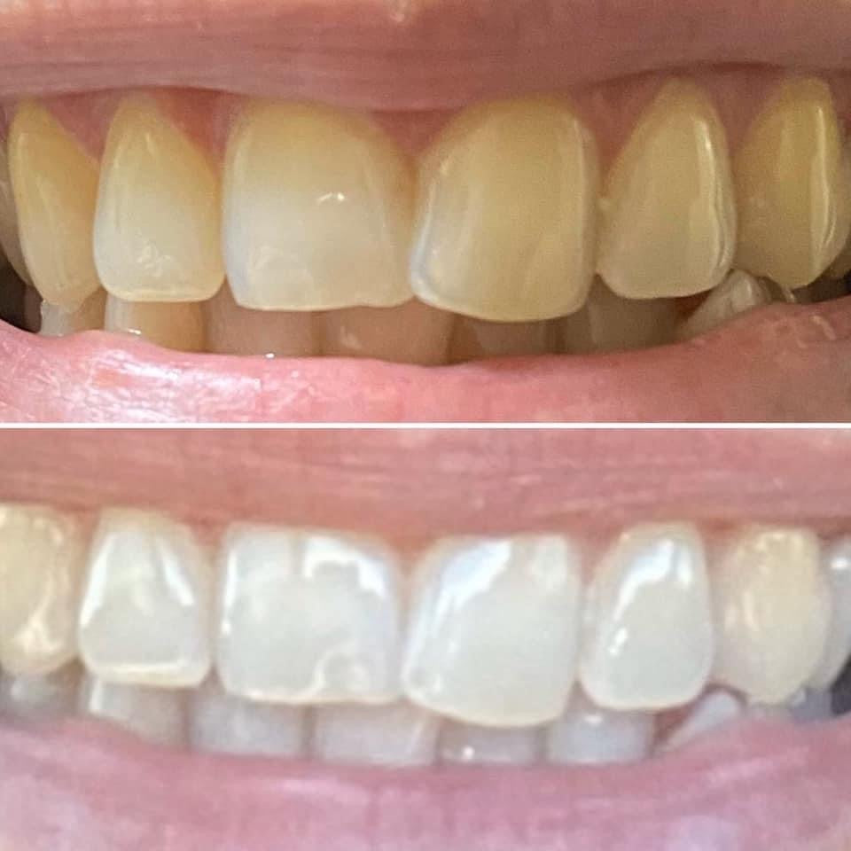 Whitening Fluoride Toothpaste